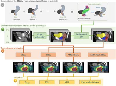 Planning With Patient-Specific Rectal Sub-Region Constraints Decreases Probability of Toxicity in Prostate Cancer Radiotherapy